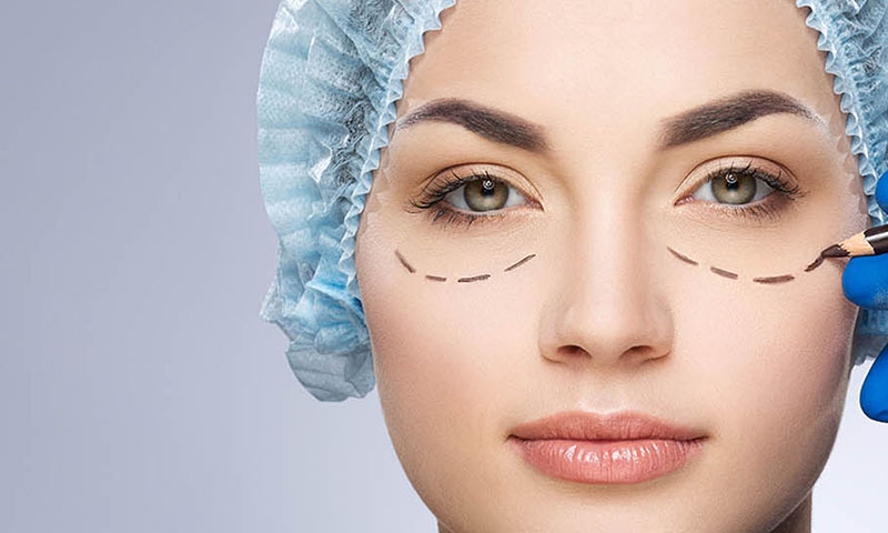 Eyelid Surgery 